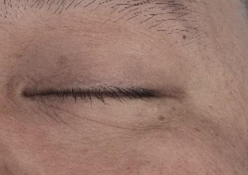 After Image