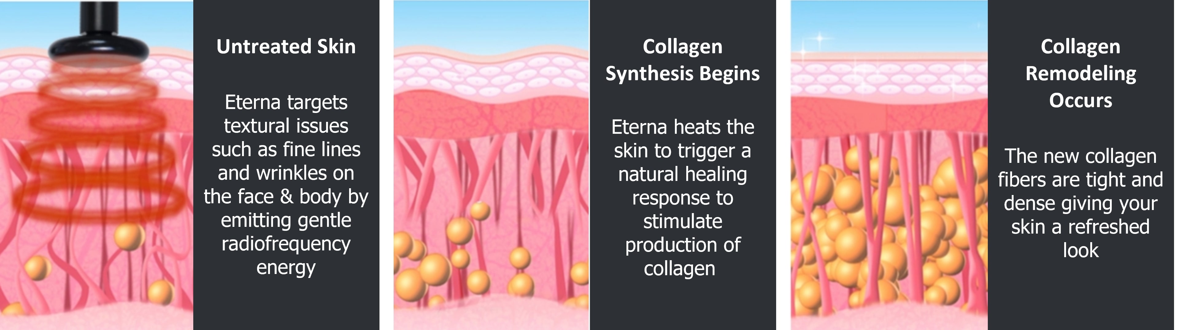 How Eterna works